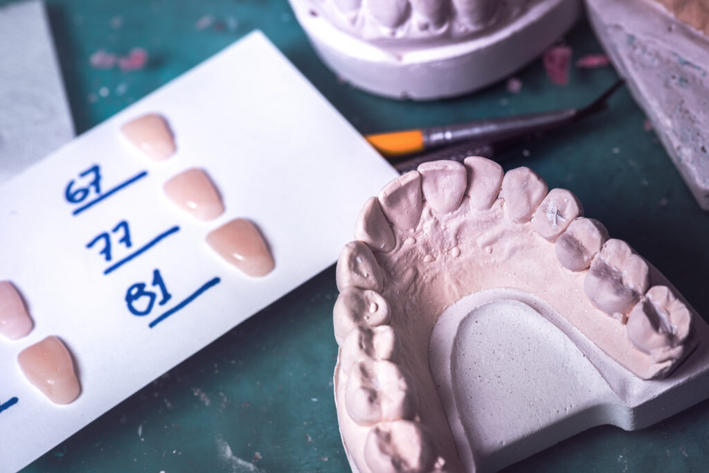 dental prosthesis prosthetic laboratory 2024 12 07 01 46 42 utc
