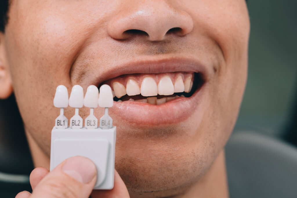 dentist sampling shades teeth he holding teeth sh 2025 04 01 20 38 52 utc